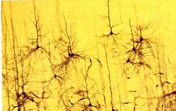 The brain as a complex network of neurons