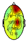 EEG analysis and prediction system (a)