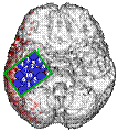 EEG analysis and prediction system (c)